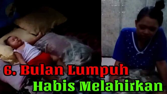 
					Nasib Ibu Muda Yang Lumpuh Paska Melahirkan Lewat Operasi Caesar