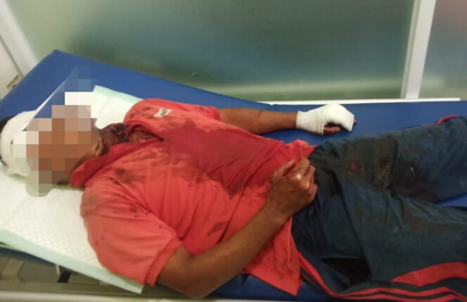 
					Akibat Hoho..Hihek Dengan Isteri Tetangga Lelaki Asal Lumajang ini Nyengir Kesakitan Kena Sajam