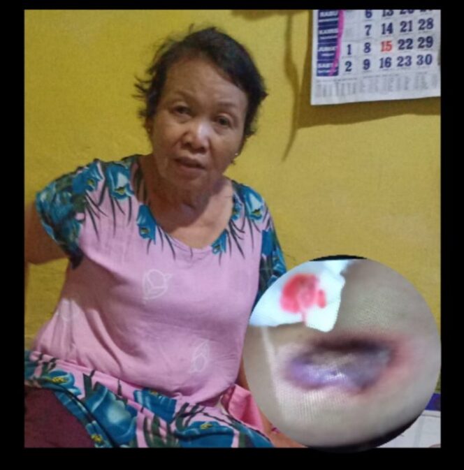 
					Jarum Suntik Dokter di Panjangjiwo, Akibatkan Pasien Alami Infeksi Hingga 2 Bulan